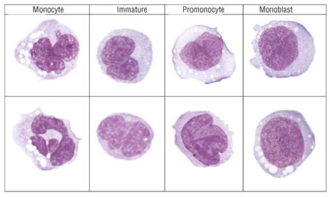 monocytes relative low|Iba pa.